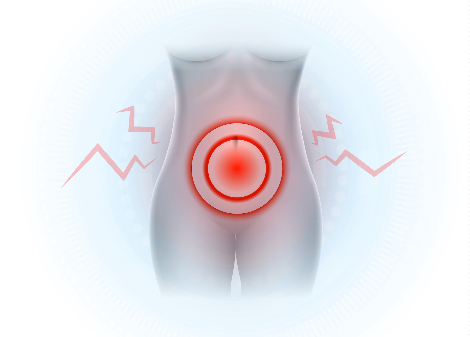 Chronic Pelvic Pain in Spanish